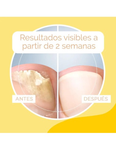 Scholl Anti-Hongos Tratamiento Para Uñas